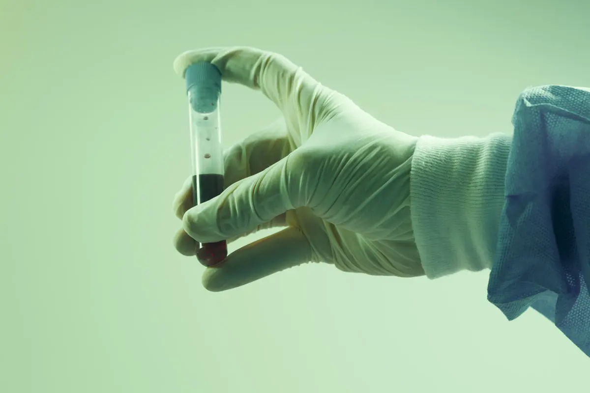 Close up of hand holding blood test
